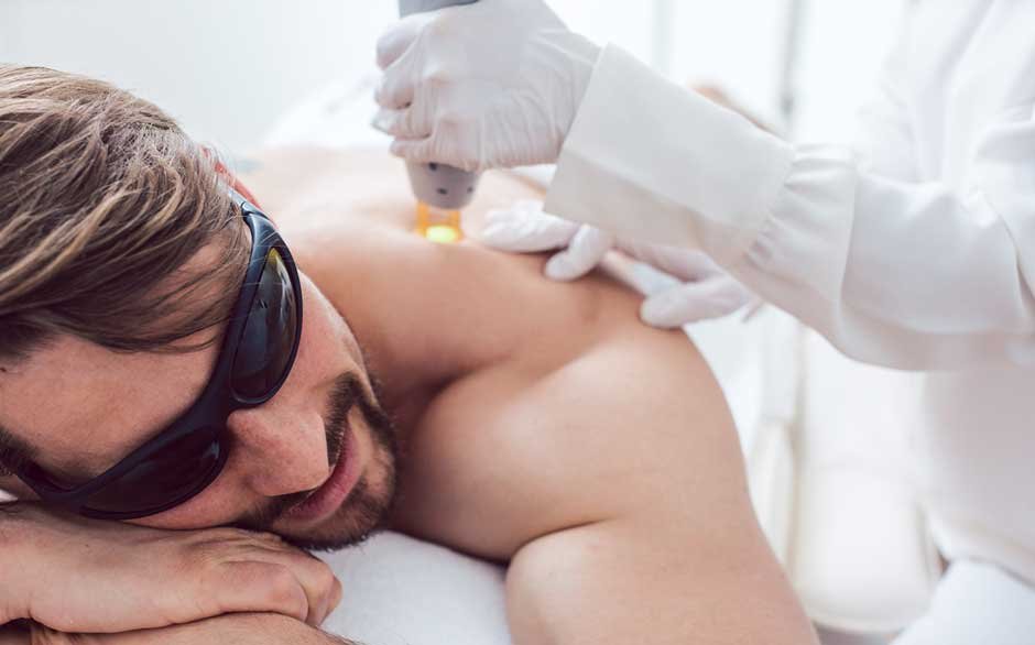 Why Choose Laser Hair Removal as a Chicago Man